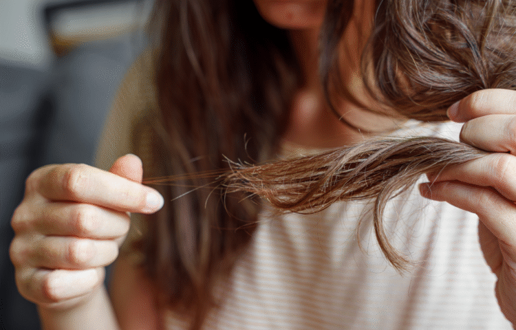 stress et chute de cheveux