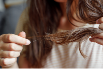 stress et chute de cheveux