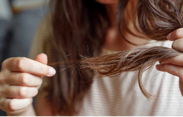 stress et chute de cheveux