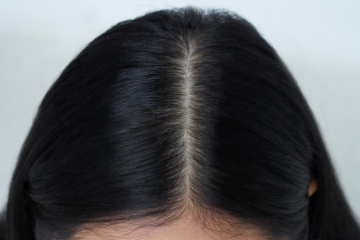 diagnostic cuir chevelu maison