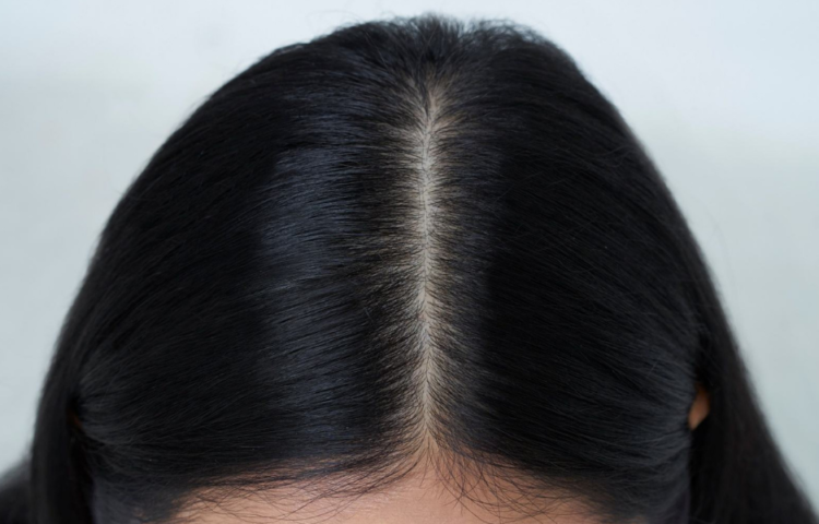 diagnostic cuir chevelu maison