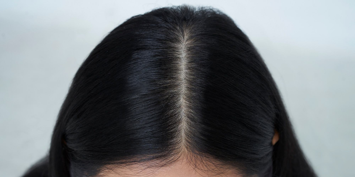 diagnostic cuir chevelu maison